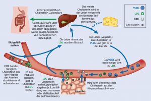 Übergewicht, Cholesterin, Abnehmen, Gewicht reduzieren